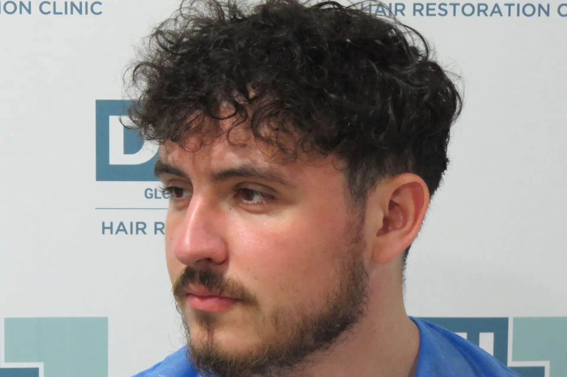 Side Profile Right Guide